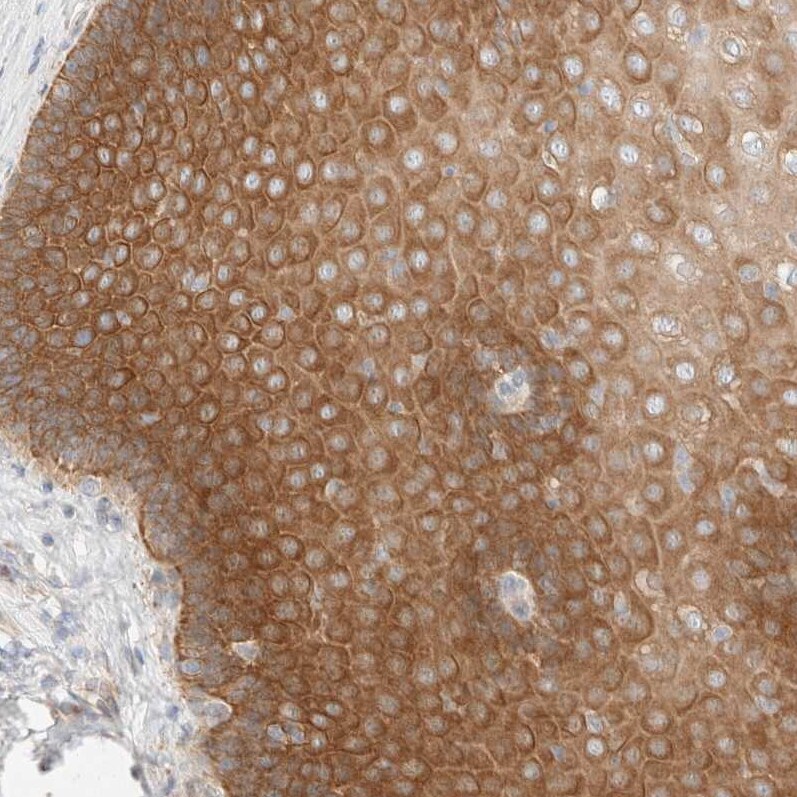 Delta 1 Tubulin Antibody - BSA Free Immunohistochemistry-Paraffin: Delta 1 Tubulin Antibody [NBP1-87391]