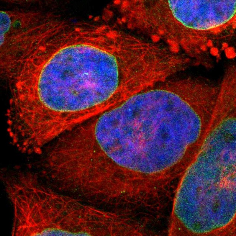 SUN1 Antibody - BSA Free Immunocytochemistry/ Immunofluorescence: SUN1 Antibody [NBP1-87396]