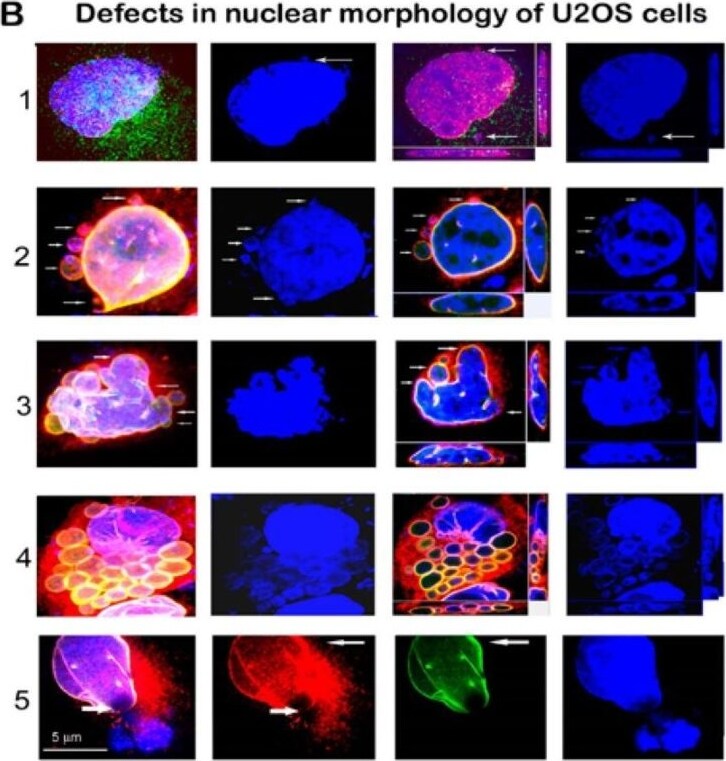SUN1 Antibody