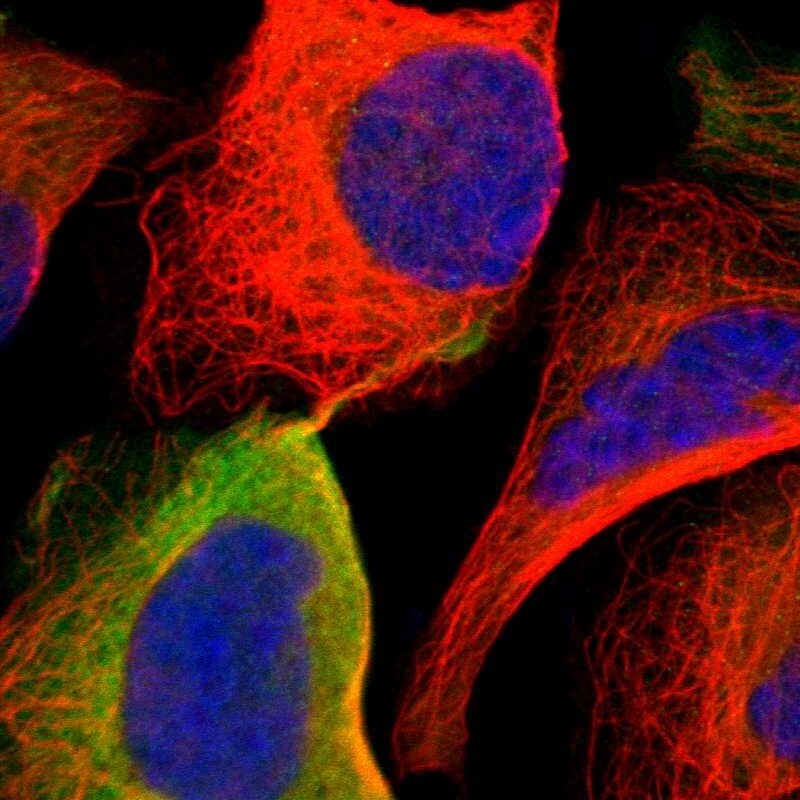 Adenosine Deaminase/ADA Antibody - BSA Free Immunocytochemistry/ Immunofluorescence: Adenosine Deaminase/ADA Antibody [NBP1-87404]