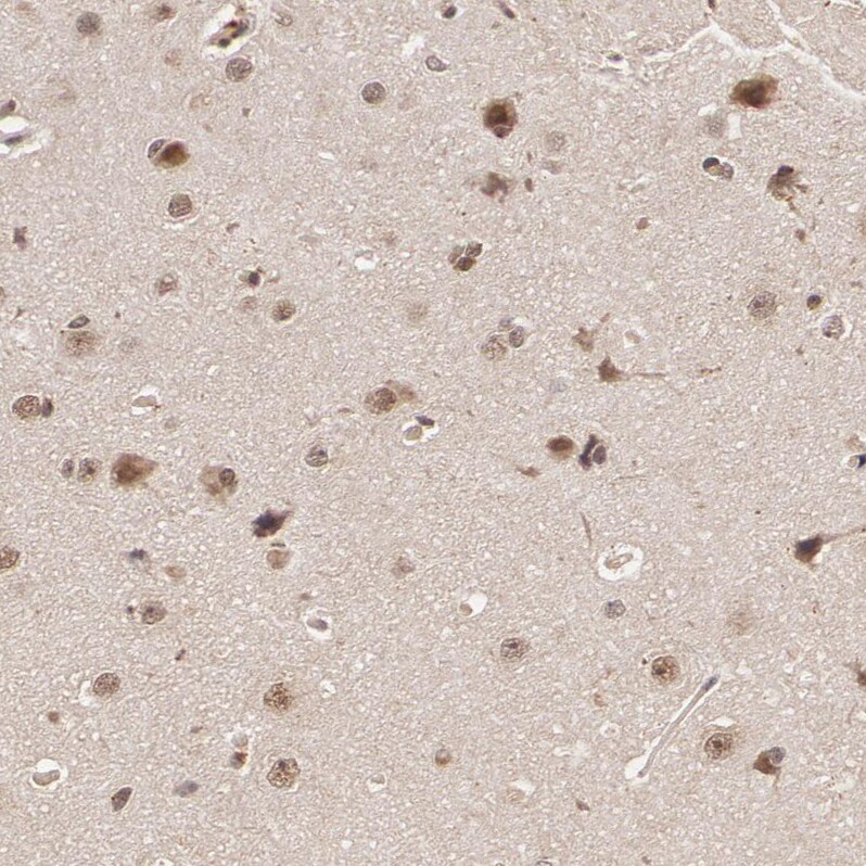 DNA Ligase IV Antibody - BSA Free Immunohistochemistry: DNA Ligase IV Antibody - BSA Free [NBP1-87405]