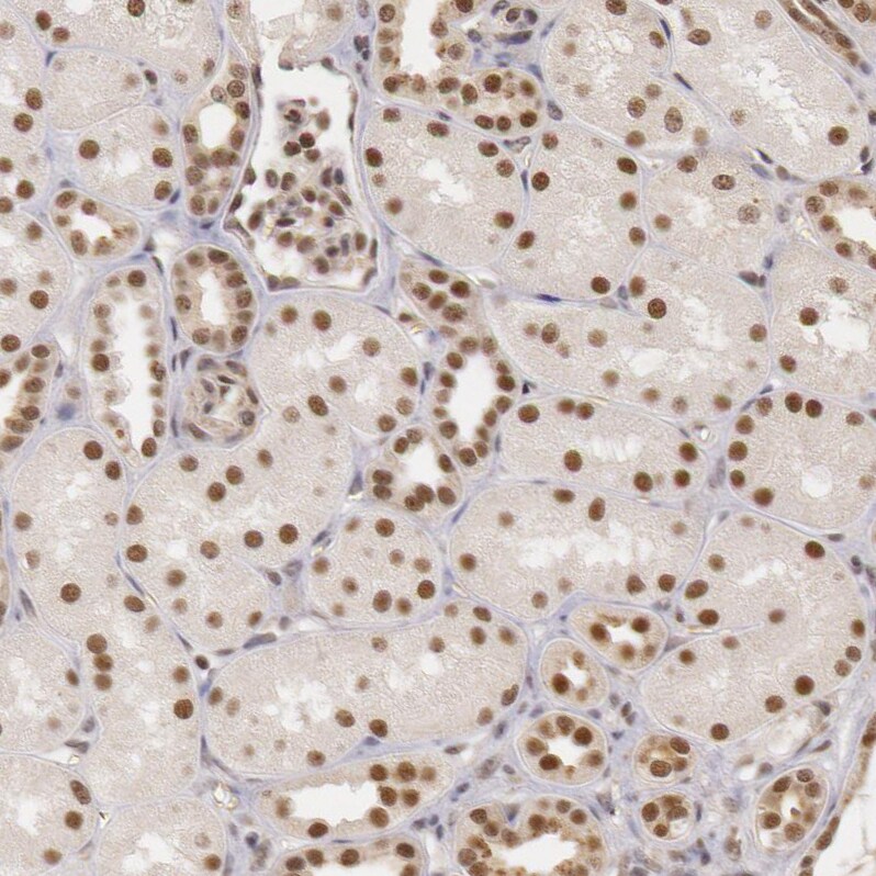 DNA Ligase IV Antibody - BSA Free Immunohistochemistry: DNA Ligase IV Antibody - BSA Free [NBP1-87405]