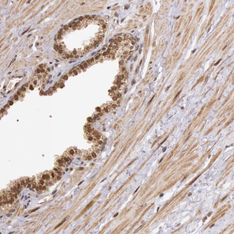 DNA Ligase IV Antibody - BSA Free Immunohistochemistry: DNA Ligase IV Antibody - BSA Free [NBP1-87405]
