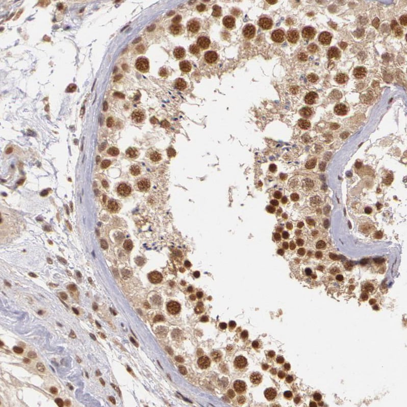 DNA Ligase IV Antibody - BSA Free Immunohistochemistry: DNA Ligase IV Antibody - BSA Free [NBP1-87405]