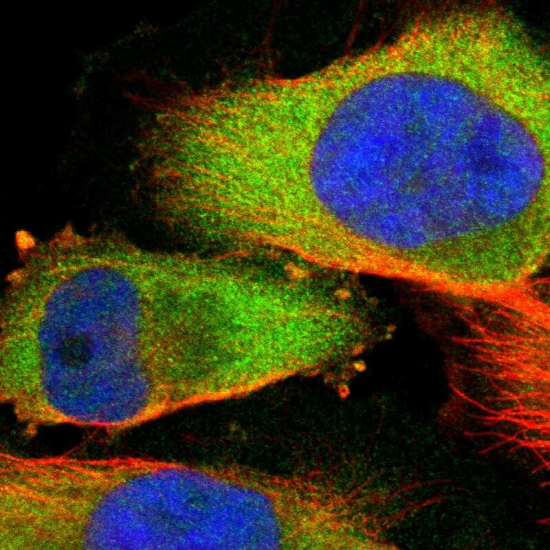 Adenylosuccinate Lyase Antibody - BSA Free Immunocytochemistry/ Immunofluorescence: Adenylosuccinate Lyase Antibody [NBP1-87406]