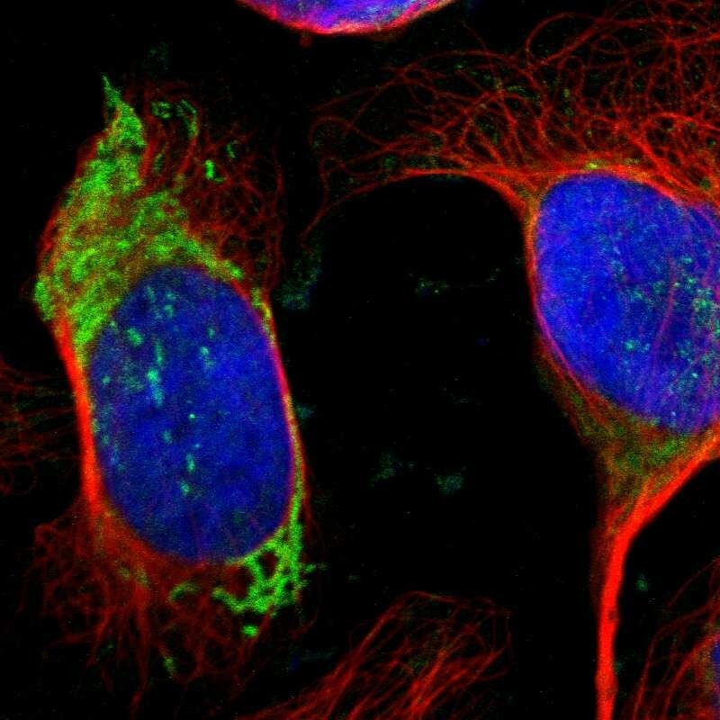 Ornithine Carbamoyltransferase Antibody - BSA Free Immunocytochemistry/ Immunofluorescence: Ornithine Carbamoyltransferase Antibody [NBP1-87408]