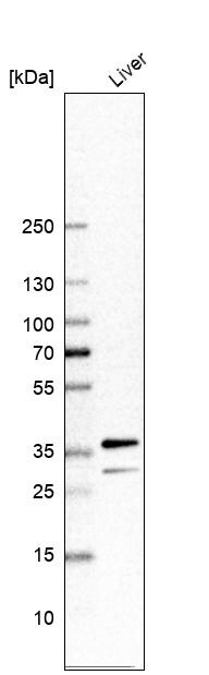Glycerol 3 Phosphate Dehydrogenase Antibody Western Blot: Glycerol 3 Phosphate Dehydrogenase Antibody [Glycerol 3 Phosphate Dehydrogenase Antibody]