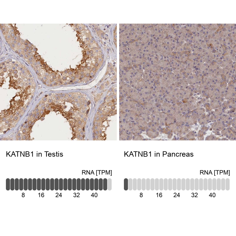 katanin-p80 Antibody - BSA Free Immunohistochemistry-Paraffin: katanin-p80 Antibody [NBP1-87413]