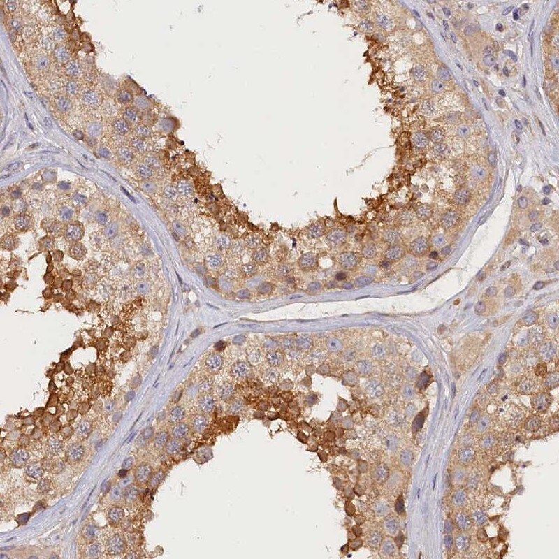 katanin-p80 Antibody - BSA Free Immunohistochemistry-Paraffin: katanin-p80 Antibody [NBP1-87413]