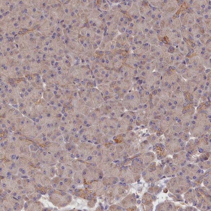 katanin-p80 Antibody - BSA Free Immunohistochemistry-Paraffin: katanin-p80 Antibody [NBP1-87413]