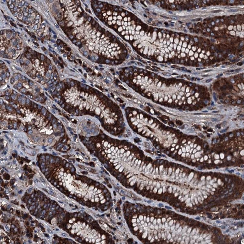 Alanyl tRNA synthetase Antibody - BSA Free Immunohistochemistry-Paraffin: Alanyl tRNA synthetase Antibody [NBP1-87414]