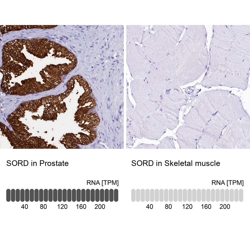 Sorbitol Dehydrogenase Antibody - BSA Free Immunohistochemistry-Paraffin: Sorbitol Dehydrogenase Antibody [NBP1-87416]