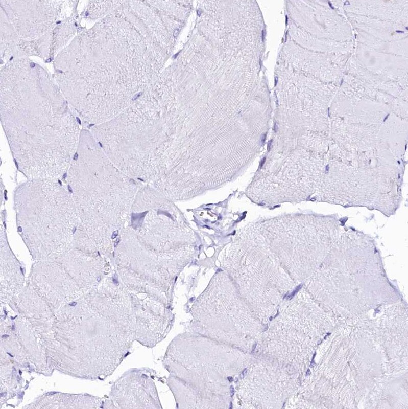Sorbitol Dehydrogenase Antibody - BSA Free Immunohistochemistry-Paraffin: Sorbitol Dehydrogenase Antibody [NBP1-87416]