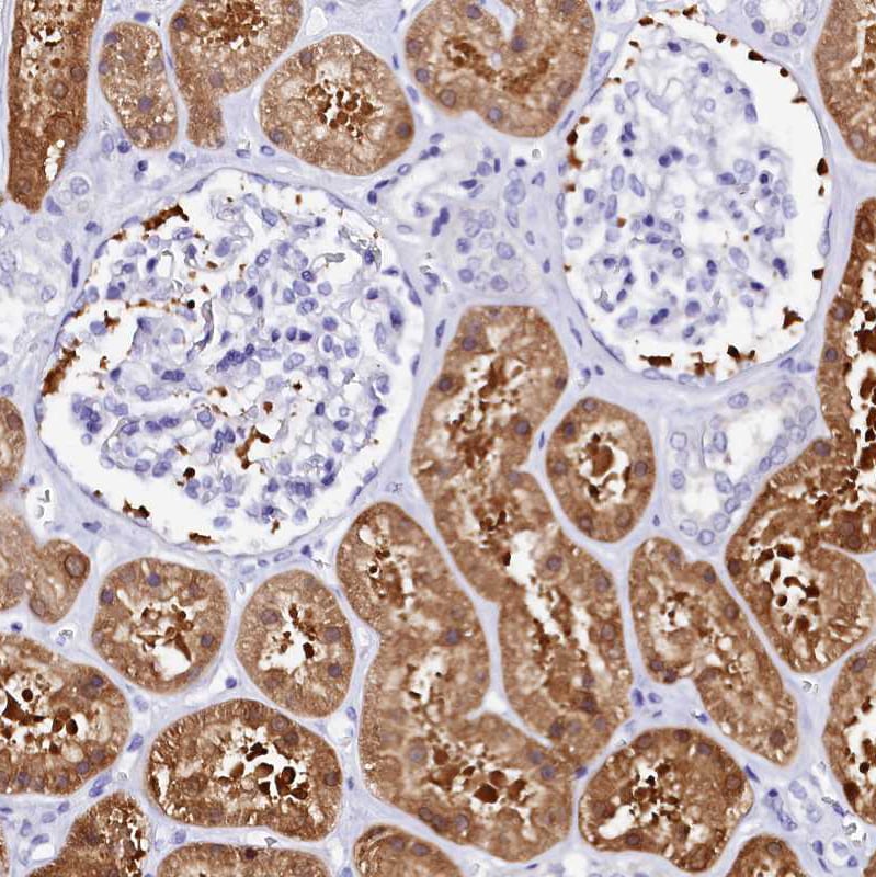 Sorbitol Dehydrogenase Antibody - BSA Free Immunohistochemistry-Paraffin: Sorbitol Dehydrogenase Antibody [NBP1-87416]