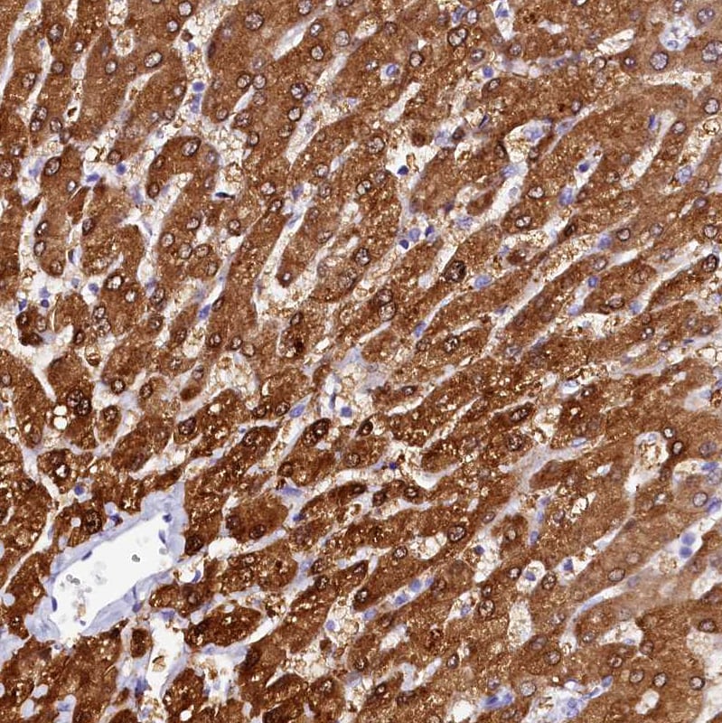 Sorbitol Dehydrogenase Antibody - BSA Free Immunohistochemistry-Paraffin: Sorbitol Dehydrogenase Antibody [NBP1-87416]