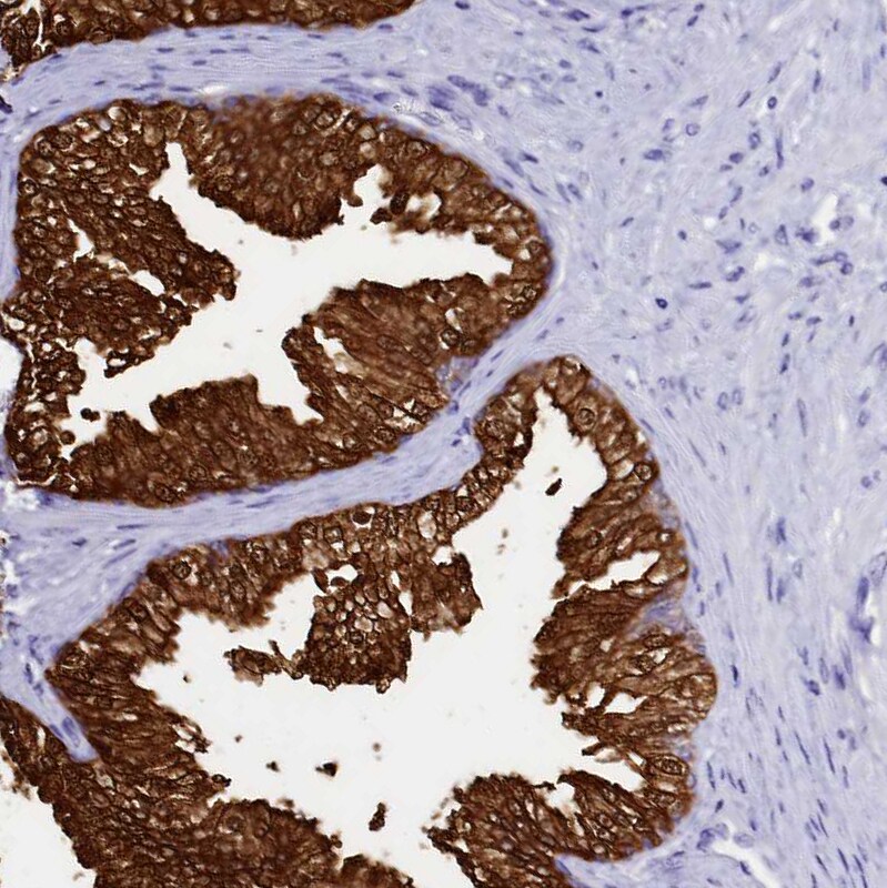 Sorbitol Dehydrogenase Antibody - BSA Free Immunohistochemistry-Paraffin: Sorbitol Dehydrogenase Antibody [NBP1-87416]