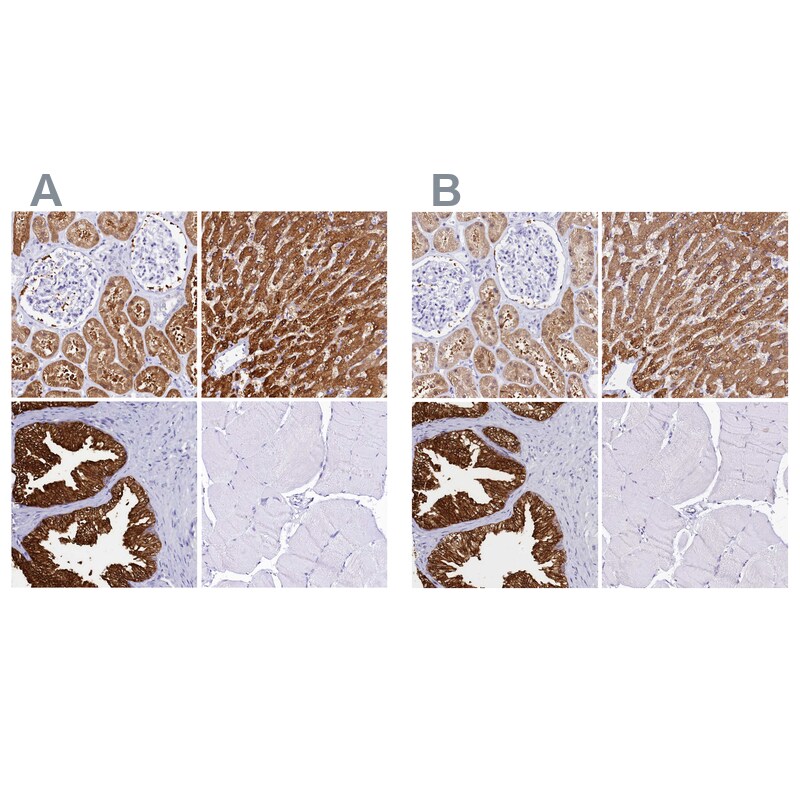Sorbitol Dehydrogenase Antibody - BSA Free Immunohistochemistry-Paraffin: Sorbitol Dehydrogenase Antibody [NBP1-87416]
