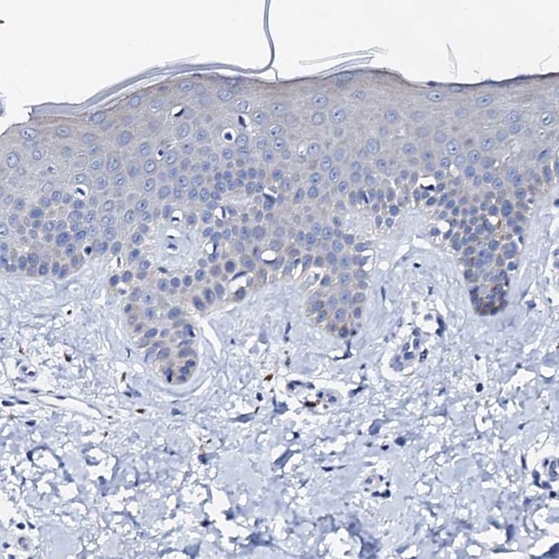 Triadin Antibody - BSA Free Immunohistochemistry-Paraffin: Triadin Antibody [NBP1-87417]