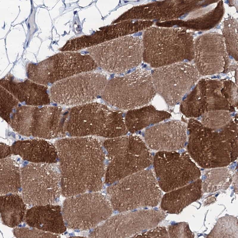 Triadin Antibody - BSA Free Immunohistochemistry-Paraffin: Triadin Antibody [NBP1-87417]