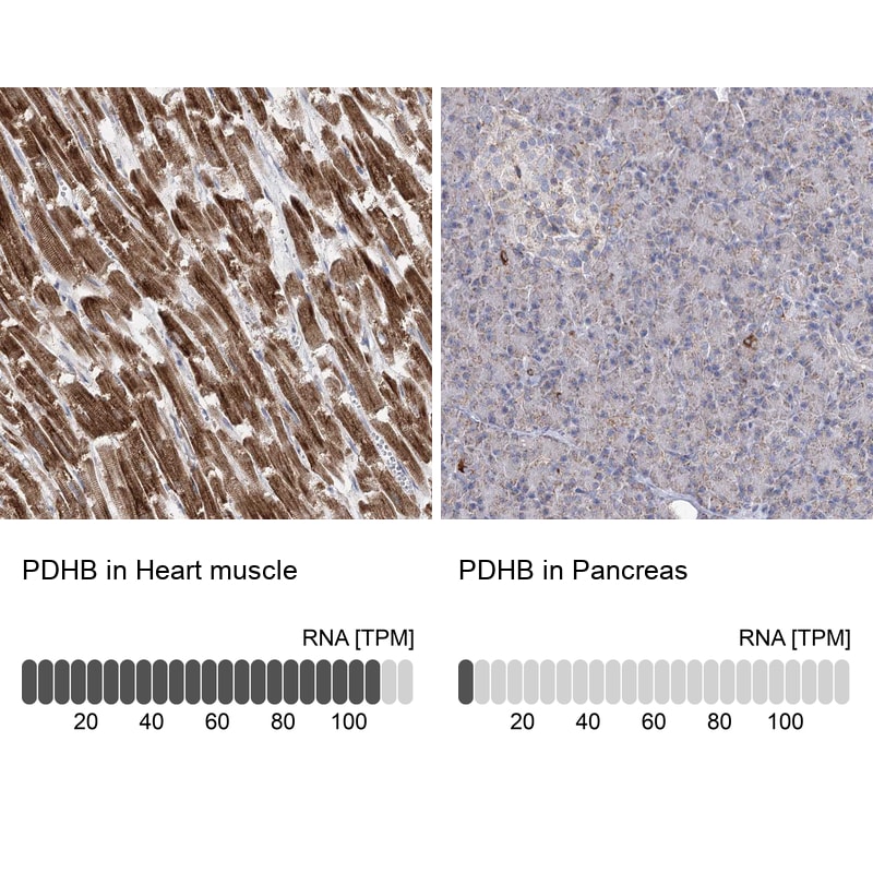 Pyruvate Dehydrogenase E1 beta subunit Antibody - BSA Free Immunohistochemistry-Paraffin: Pyruvate Dehydrogenase E1 beta subunit Antibody [NBP1-87421]