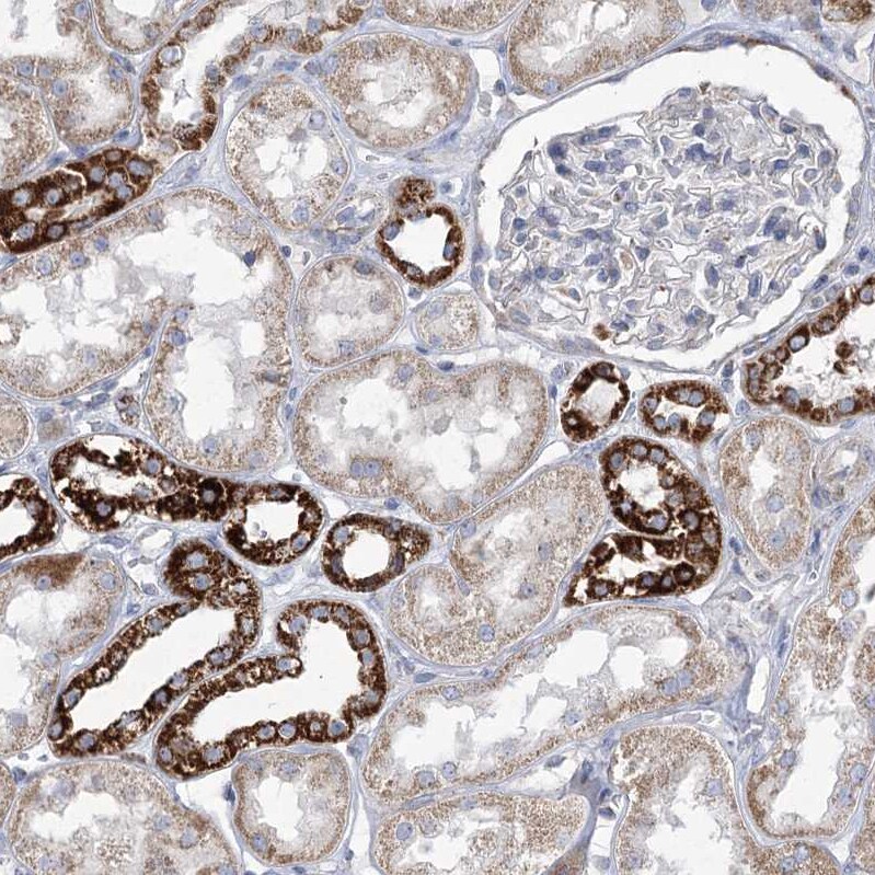 Pyruvate Dehydrogenase E1 beta subunit Antibody - BSA Free Immunohistochemistry-Paraffin: Pyruvate Dehydrogenase E1 beta subunit Antibody [NBP1-87421]