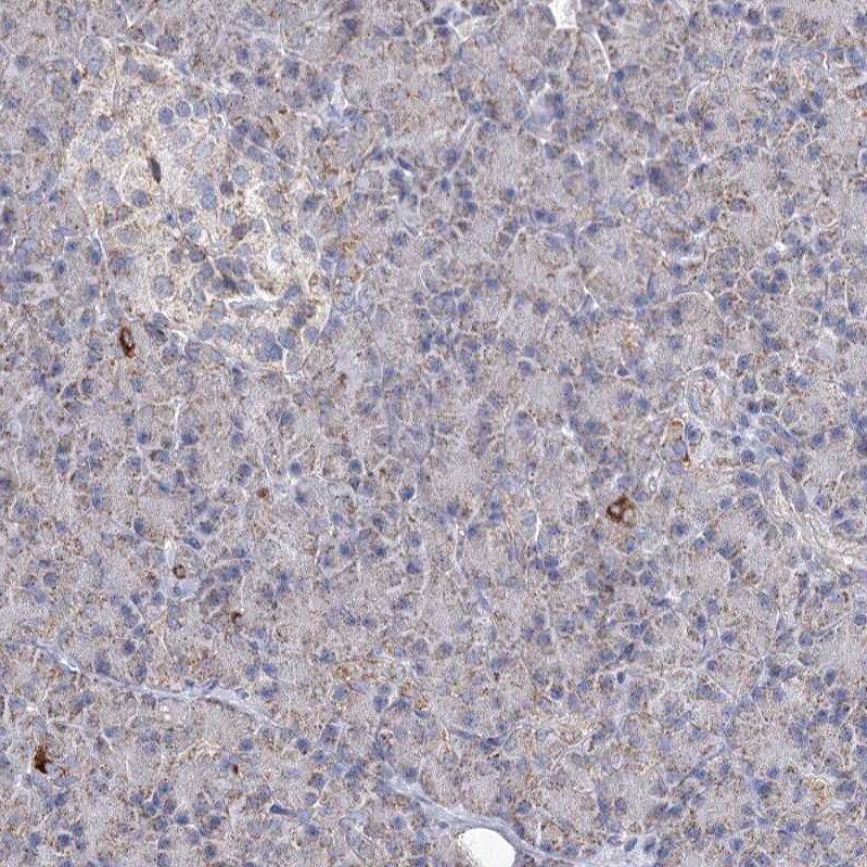 Pyruvate Dehydrogenase E1 beta subunit Antibody - BSA Free Immunohistochemistry-Paraffin: Pyruvate Dehydrogenase E1 beta subunit Antibody [NBP1-87421]