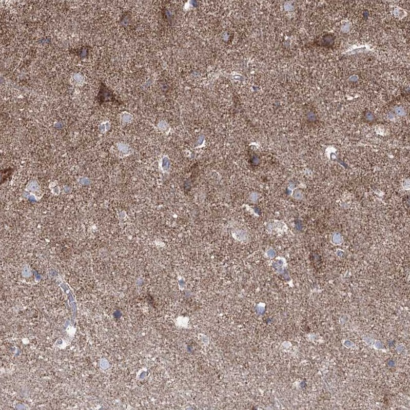 Pyruvate Dehydrogenase E1 beta subunit Antibody - BSA Free Immunohistochemistry-Paraffin: Pyruvate Dehydrogenase E1 beta subunit Antibody [NBP1-87421]