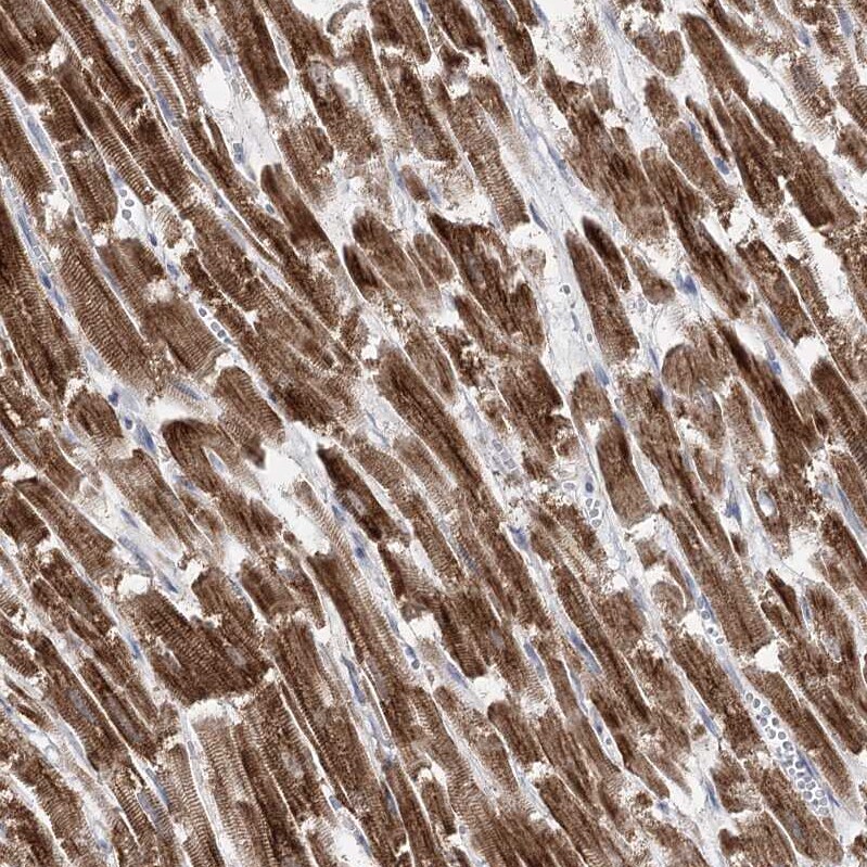 Pyruvate Dehydrogenase E1 beta subunit Antibody - BSA Free Immunohistochemistry-Paraffin: Pyruvate Dehydrogenase E1 beta subunit Antibody [NBP1-87421]
