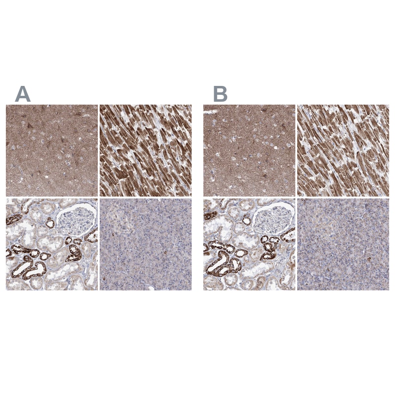 Pyruvate Dehydrogenase E1 beta subunit Antibody - BSA Free Immunohistochemistry-Paraffin: Pyruvate Dehydrogenase E1 beta subunit Antibody [NBP1-87421]