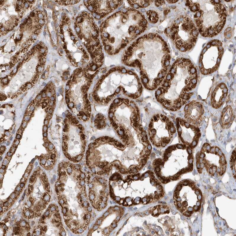 Methylmalonyl Coenzyme A mutase Antibody - BSA Free Immunohistochemistry-Paraffin: Methylmalonyl Coenzyme A mutase Antibody [NBP1-87423]