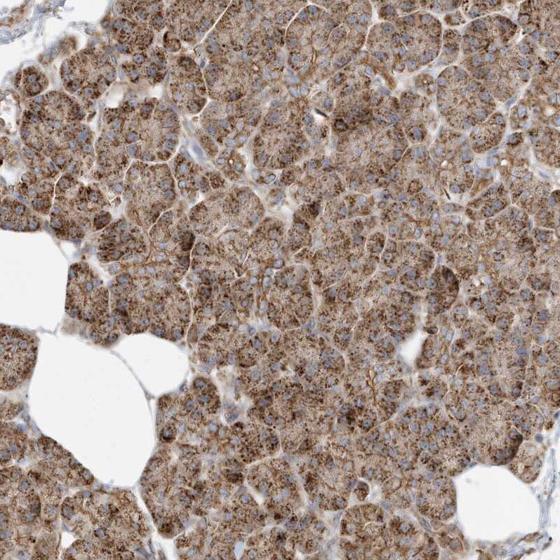 Methylmalonyl Coenzyme A mutase Antibody - BSA Free Immunohistochemistry-Paraffin: Methylmalonyl Coenzyme A mutase Antibody [NBP1-87423]