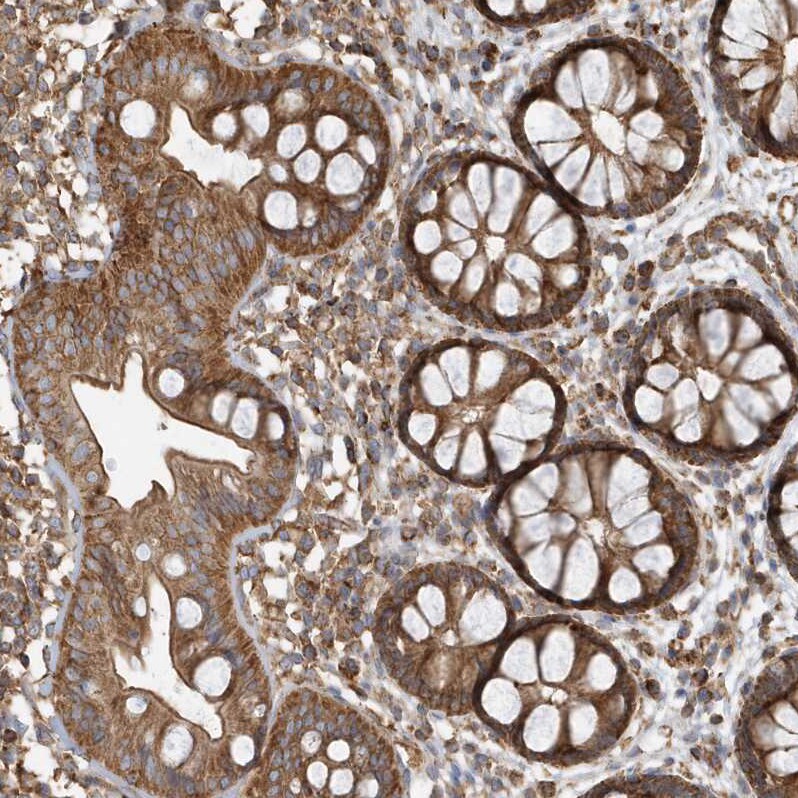 Methylmalonyl Coenzyme A mutase Antibody - BSA Free Immunohistochemistry-Paraffin: Methylmalonyl Coenzyme A mutase Antibody [NBP1-87423]
