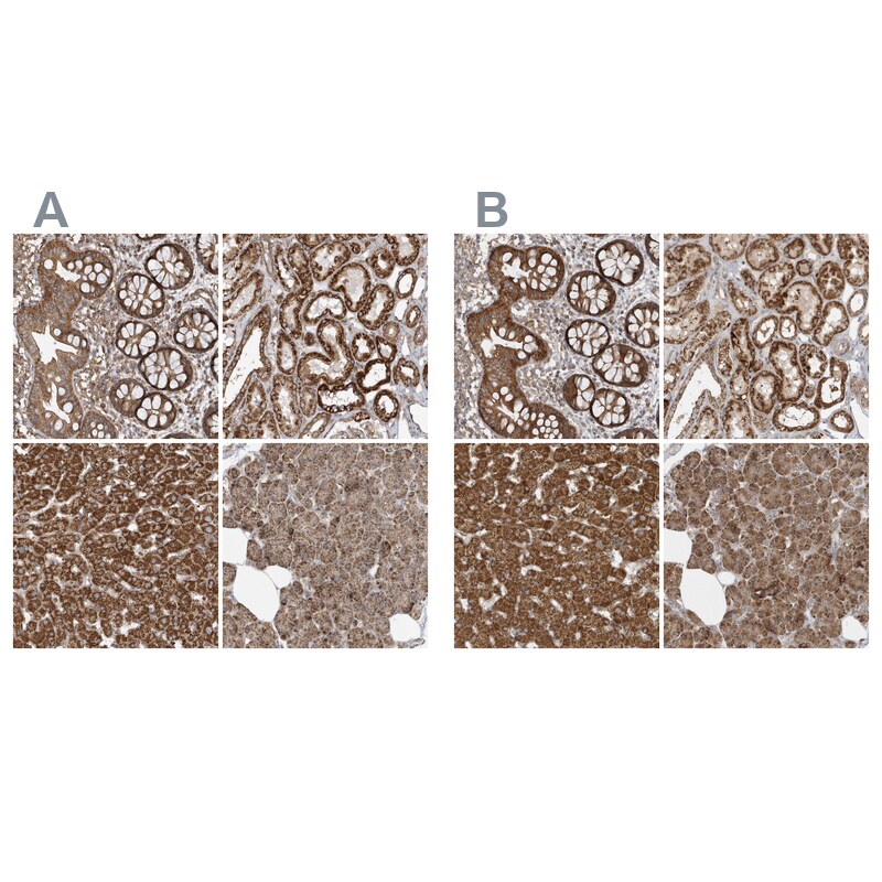 Methylmalonyl Coenzyme A mutase Antibody - BSA Free Immunohistochemistry-Paraffin: Methylmalonyl Coenzyme A mutase Antibody [NBP1-87423]
