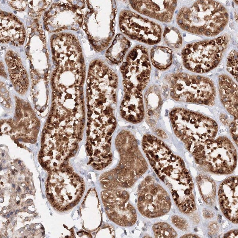 Deoxycytidylate deaminase Antibody - BSA Free Immunohistochemistry-Paraffin: Deoxycytidylate deaminase Antibody [NBP1-87424]