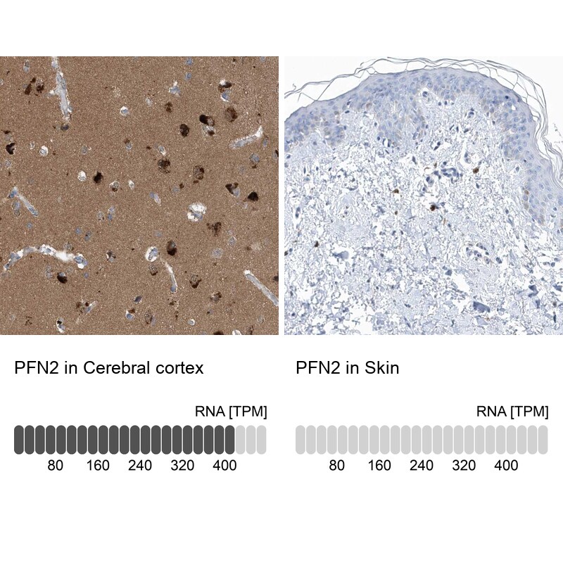 Profilin 2 Antibody - BSA Free Immunohistochemistry-Paraffin: Profilin 2 Antibody [NBP1-87426]