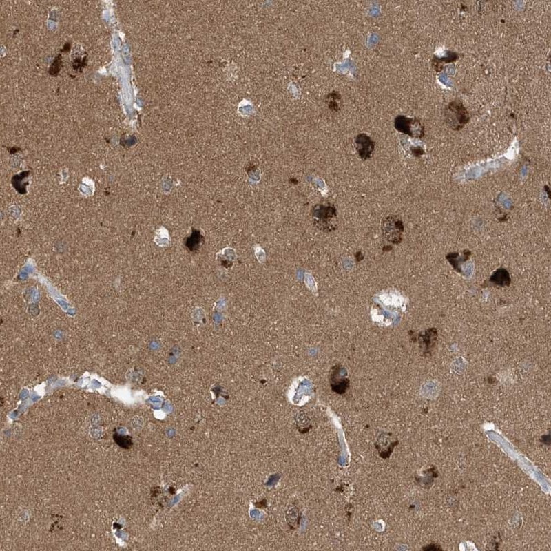 Profilin 2 Antibody - BSA Free Immunohistochemistry-Paraffin: Profilin 2 Antibody [NBP1-87426]