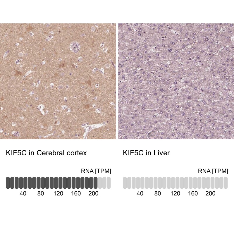 Kinesin 5C Antibody - BSA Free Immunohistochemistry-Paraffin: Kinesin 5C Antibody [NBP1-87429]