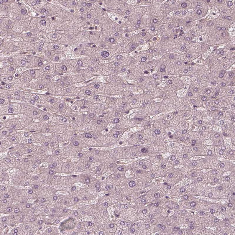 Kinesin 5C Antibody - BSA Free Immunohistochemistry-Paraffin: Kinesin 5C Antibody [NBP1-87429]
