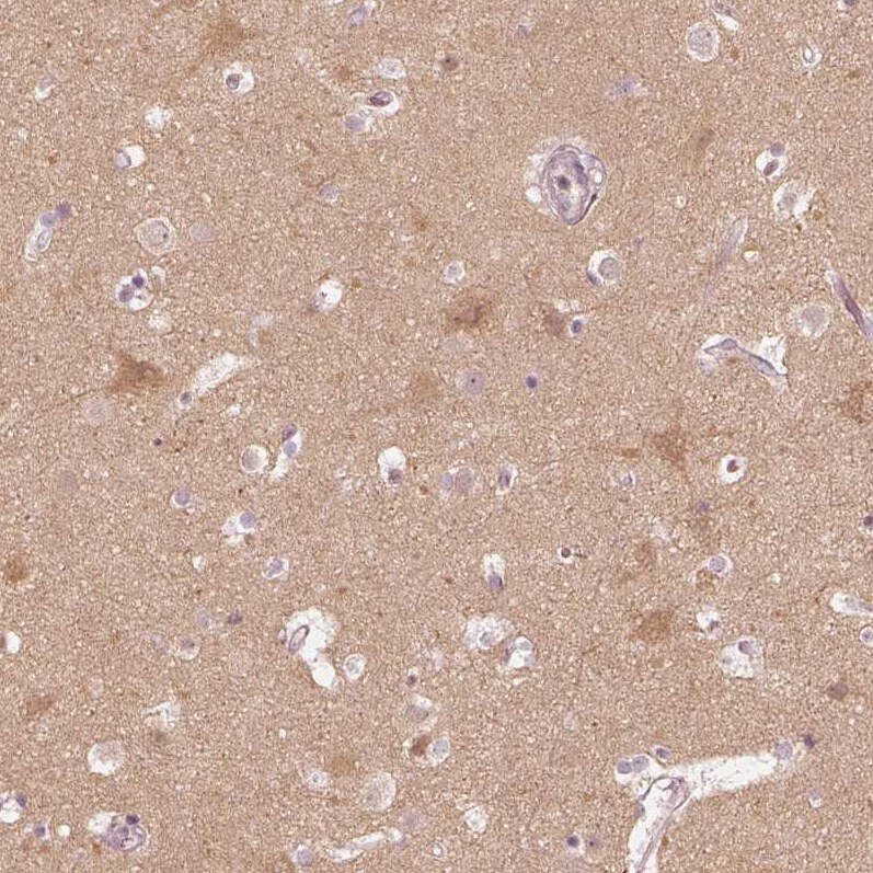 Kinesin 5C Antibody - BSA Free Immunohistochemistry-Paraffin: Kinesin 5C Antibody [NBP1-87429]