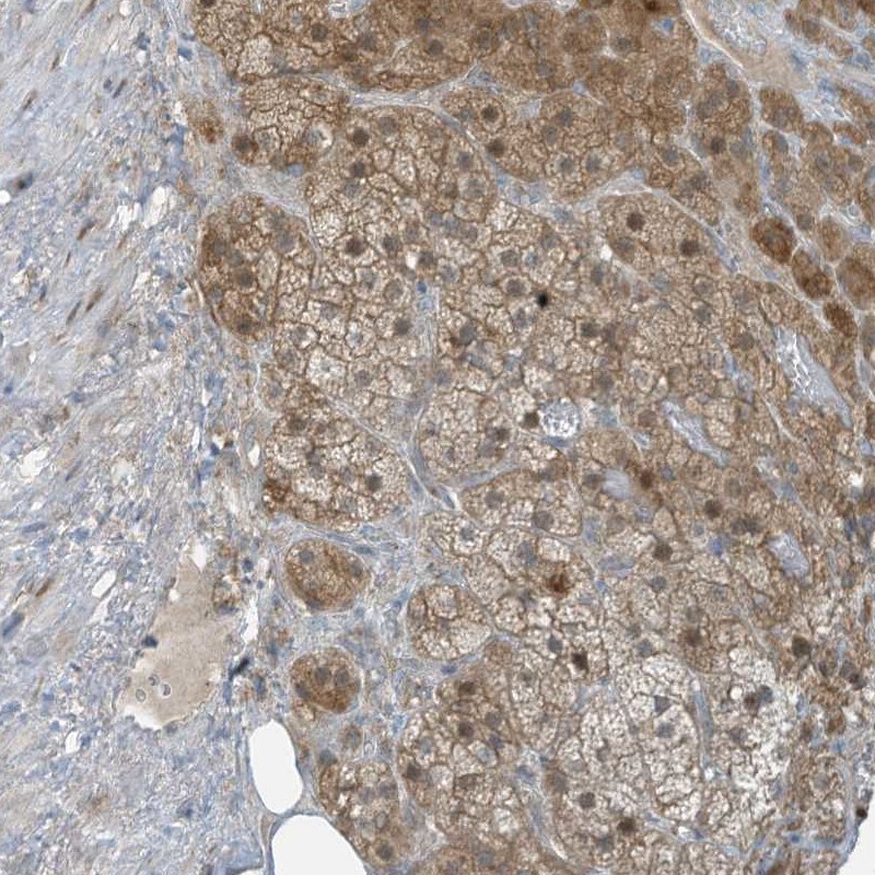 Parvin gamma Antibody Immunohistochemistry-Paraffin: Parvin gamma Antibody [NBP1-87433]