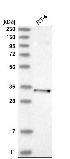 Parvin gamma Antibody Western Blot: WDR12 Antibody [NBP1-87433]