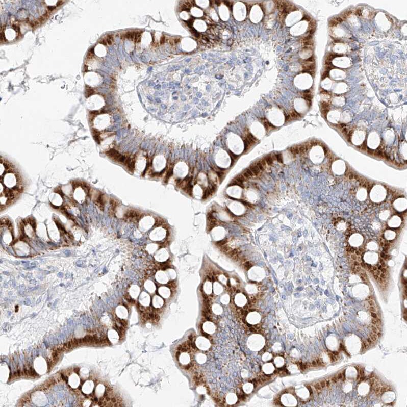 Metaxin-2 Antibody - BSA Free Immunohistochemistry-Paraffin: Metaxin-2 Antibody [NBP1-87436]