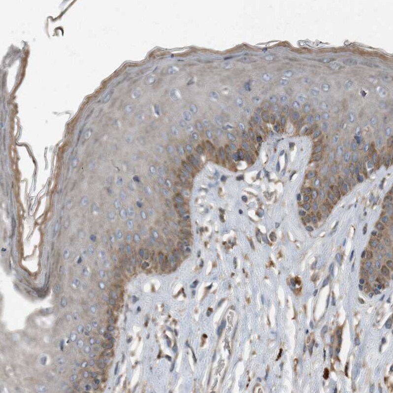 Complement Component C9 Antibody - BSA Free Immunohistochemistry-Paraffin: Complement Component C9 Antibody [NBP1-87440]