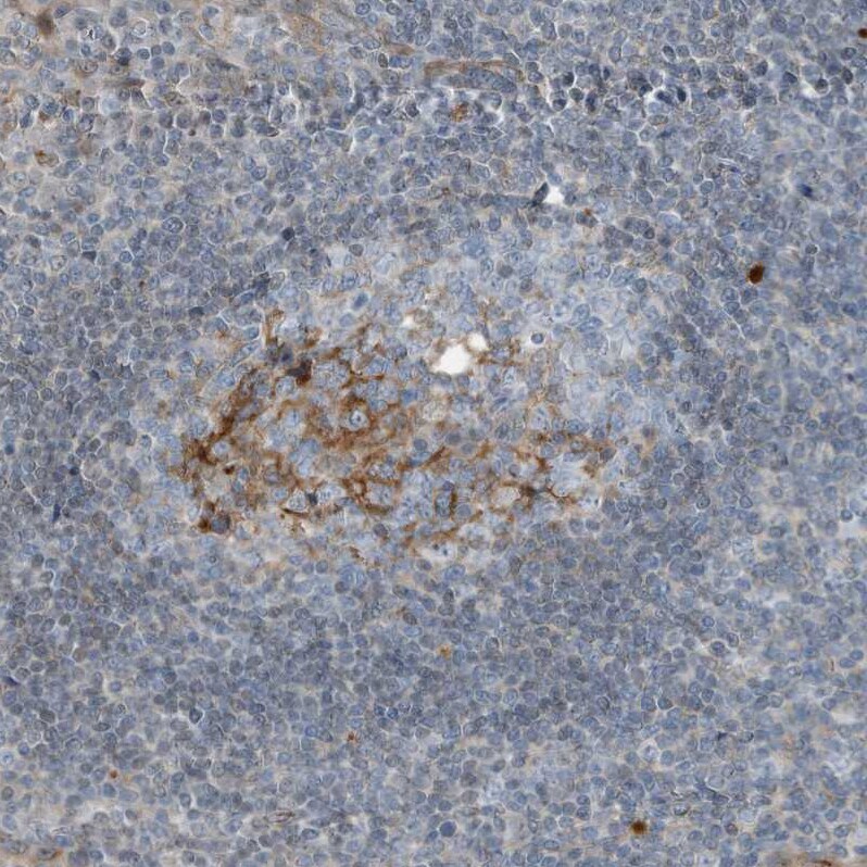 Complement Component C9 Antibody - BSA Free Immunohistochemistry-Paraffin: Complement Component C9 Antibody [NBP1-87440]