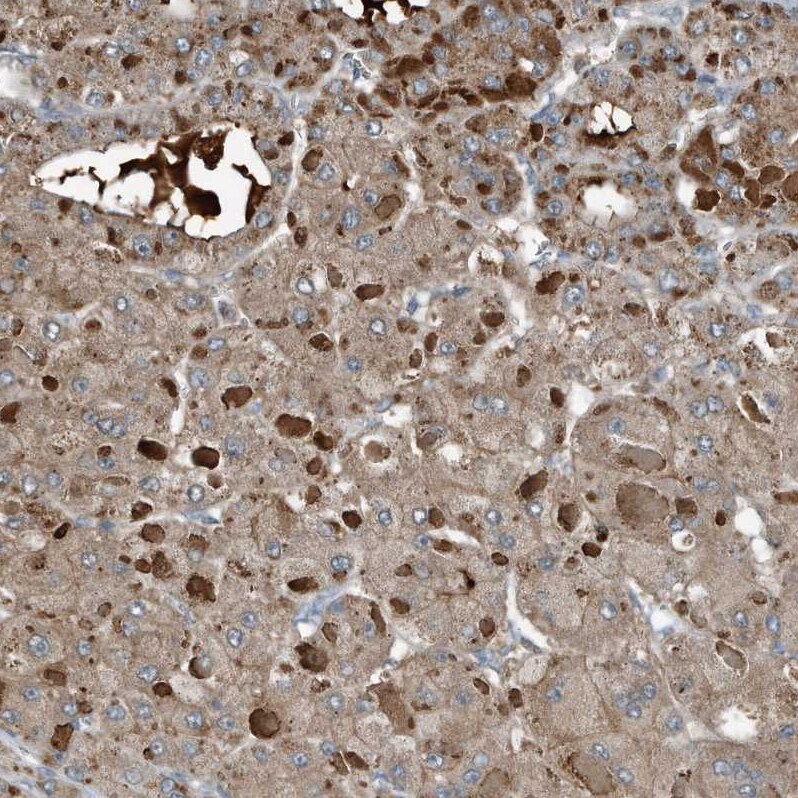 Complement Component C9 Antibody - BSA Free Immunohistochemistry-Paraffin: Complement Component C9 Antibody [NBP1-87440]