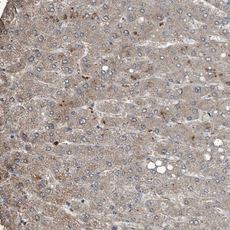 Complement Component C9 Antibody - BSA Free Immunohistochemistry-Paraffin: Complement Component C9 Antibody [NBP1-87440]