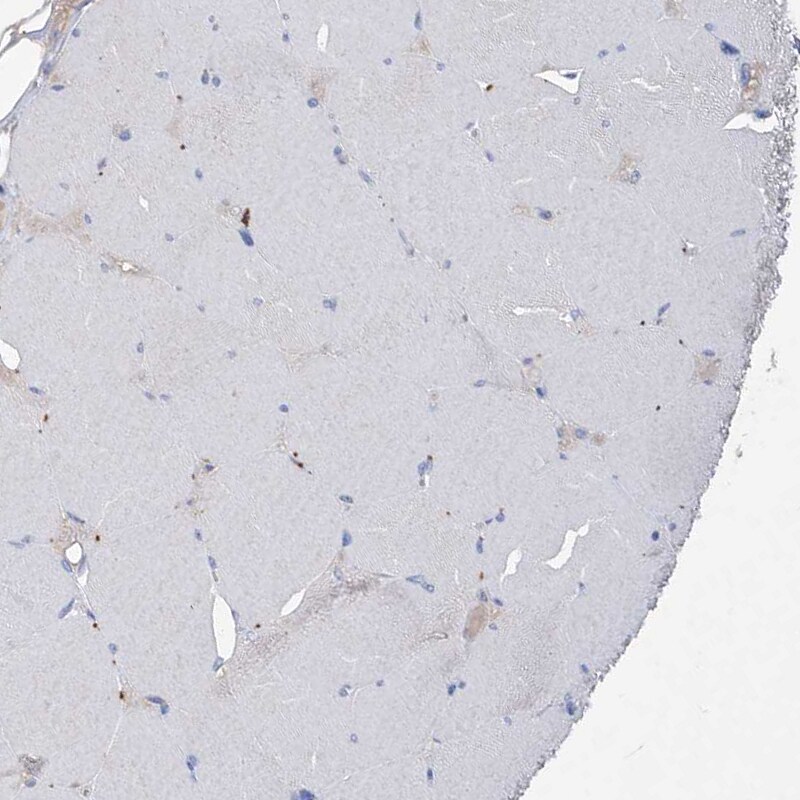 Asparagine synthetase Antibody - BSA Free Immunohistochemistry-Paraffin: Asparagine synthetase Antibody [NBP1-87444]