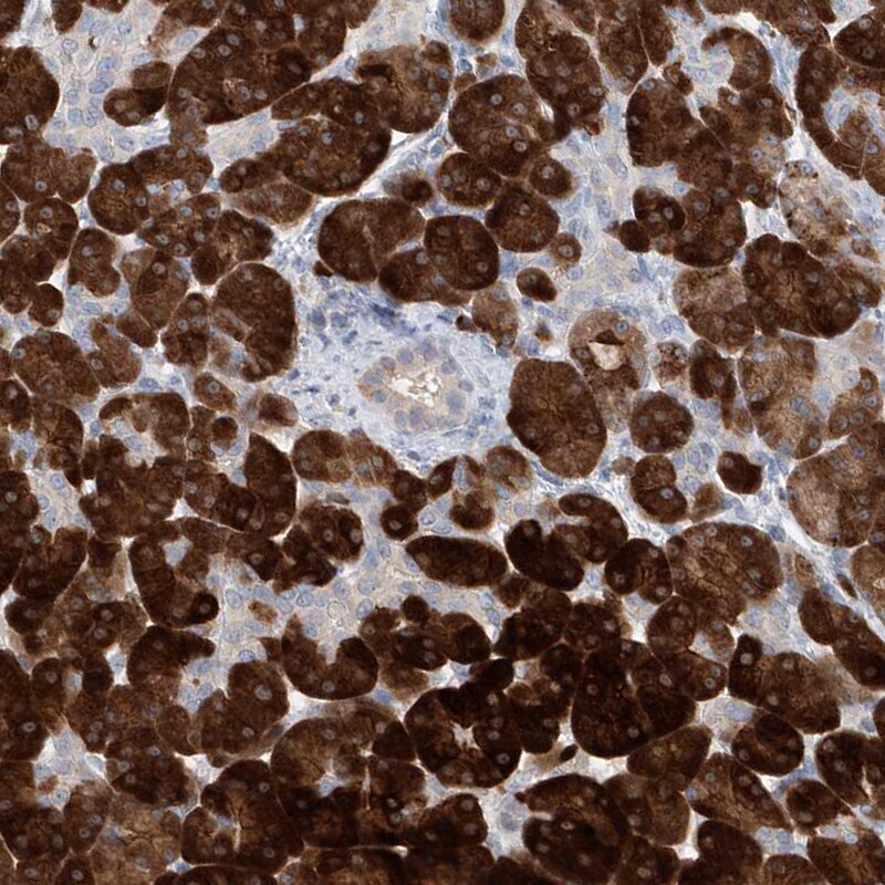 Asparagine synthetase Antibody - BSA Free Immunohistochemistry-Paraffin: Asparagine synthetase Antibody [NBP1-87444]