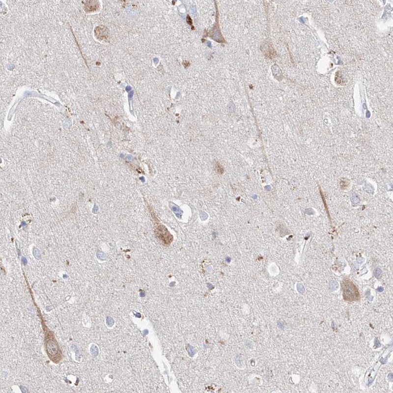 Asparagine synthetase Antibody - BSA Free Immunohistochemistry-Paraffin: Asparagine synthetase Antibody [NBP1-87444]
