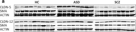 Claudin-12 Antibody